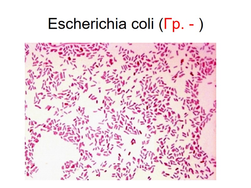 Escherichia coli (Гр. - )
